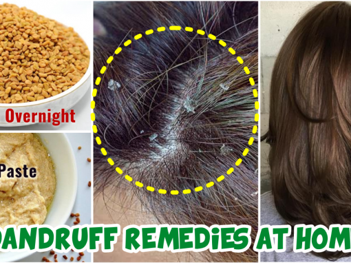 علاج قشرة الشعر الشديدة بالأعشاب من أول مرة للإستخدام آمن وصحي