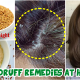 علاج قشرة الشعر الشديدة بالأعشاب من أول مرة للإستخدام آمن وصحي
